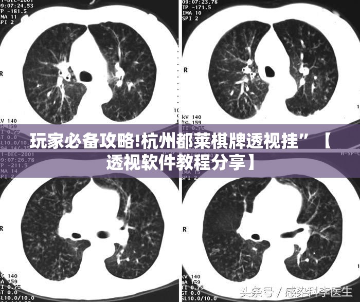 玩家必备攻略!杭州都莱棋牌透视挂	”【透视软件教程分享】